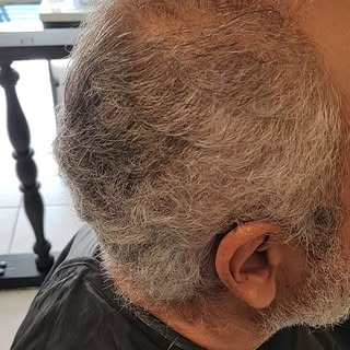 Rejuvenesça 10 Anos!