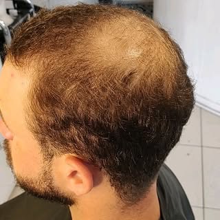 Venha rejuvenescer Também! Whatsapp 19 9.9669-5539