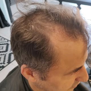 Prótese Capilar whatsapp 19 9.9669-5539