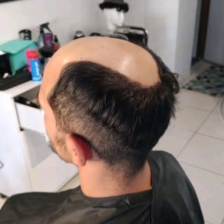 Rejuvenesça 10 anos. Eleve a sua Auto Estima.
