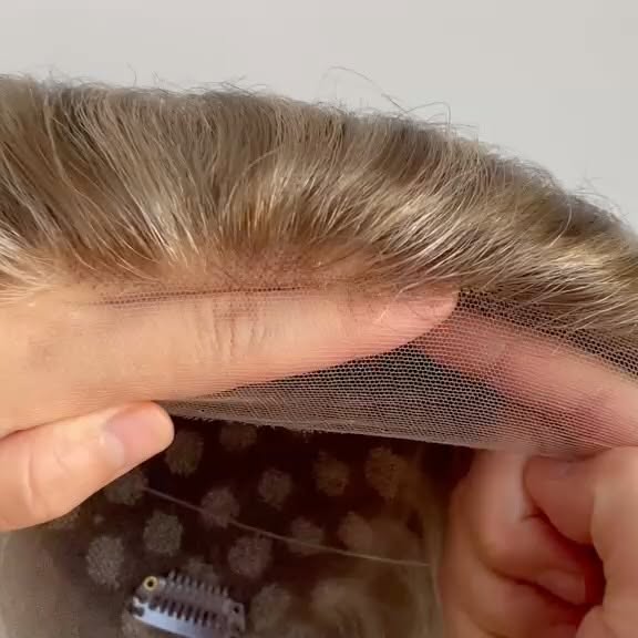 Frontale fibroserende alopecia (FFA) is een vorm van littekenvormende haaruitval waarbij de voorste 