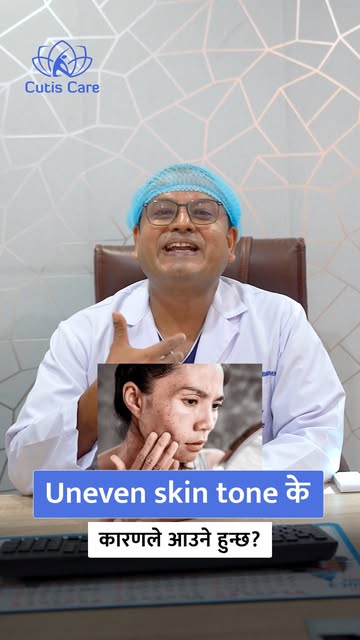 Struggling with uneven skin tone? 🤔 You're not alone!

In this video, Prof. Dr. Dharmendra Karn, De