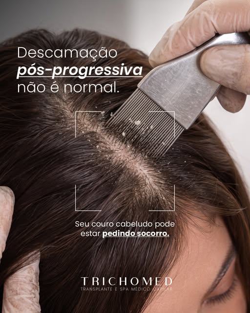Seu couro cabeludo também precisa de atenção depois de um procedimento químico e a gente te explica 