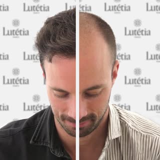 Un avant-après qui parle de lui-même… en seulement 6 mois ! ✨

Prêt pour votre propre transformation