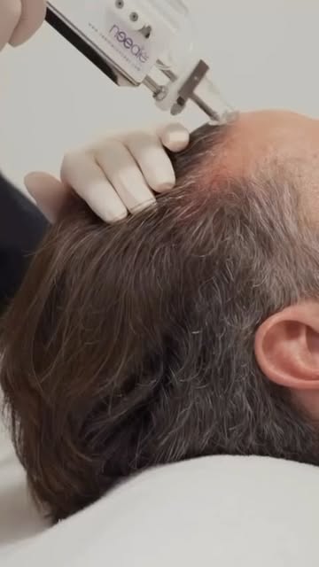 Deux traitements complémentaires. Une même ambition : révéler tout le potentiel de vos cheveux.​
​
L