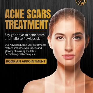 Achieve smoother, clearer, and more radiant skin with advanced acne scar treatments designed for vis