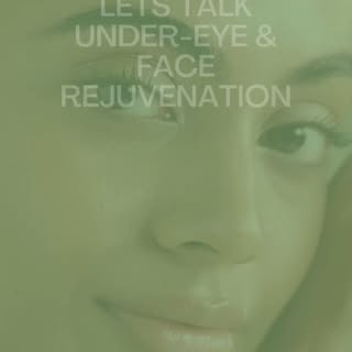 💉PRF Ez Gel is an alternative to injectable dermal filler in tricky, higher risk areas like the und