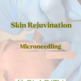 I’m just a girl..who refuses to let pores win 🎀

Microneedling (do with PRP for more benefits) is t
