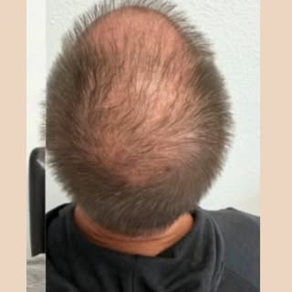 Struggling with thinning hair, hair loss, or weak, brittle strands? 😔 You’re not alone, and we’ve g