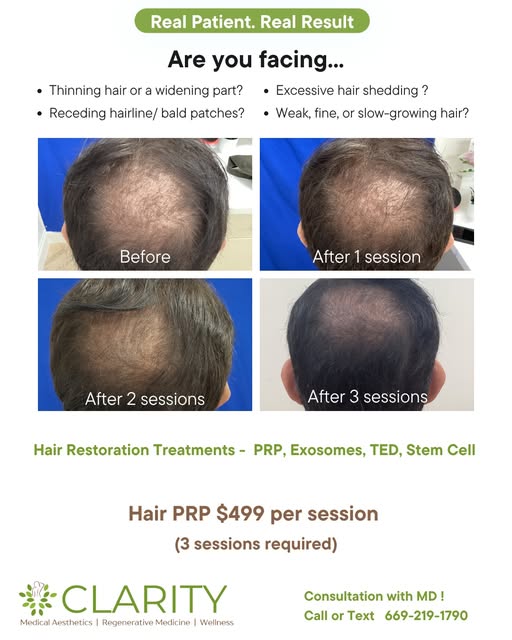 Struggling with thinning hair, hair loss, or weak, brittle strands? 😔 You’re not alone, and we’ve g