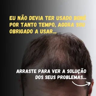 Você tem esse problema? Arrasta para o lado e veja que a solução mais simples do mundo você encontra