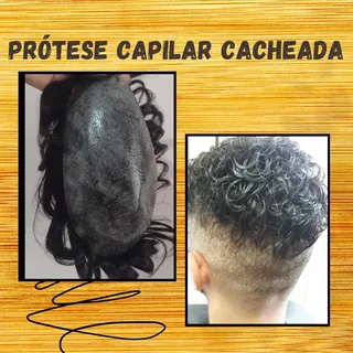 Prótese Capilar Cacheada, Não existe motivos para você não voltar a ser feliz!
Aqui na Autoestima vo