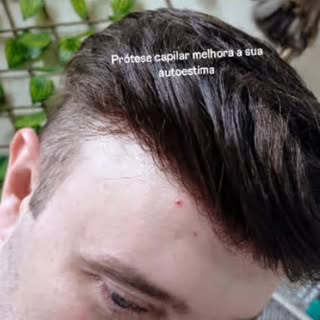 @autiestimaprotesecapilar
