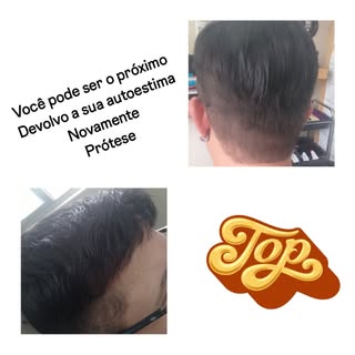 #cabelo #autoestima #protesecapilar #cabelonatural #corte #corteperfeito #cabelohumano #protesecabel