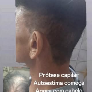 Você pode ser o próximo,com cabelo se faz a diferença 😊
