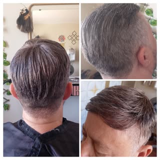 Prótese capilar o cabelo que cobre a calvície.