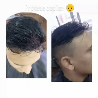 #cabelo #protesecapilar #autoestima #renovação #rejuvelhecer