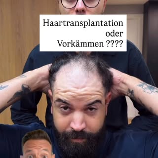 Haarausfall? Die richtige Frisur kann schon viel ausmachen und lichte Stellen gekonnt kaschieren. 💇