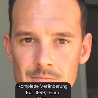 Was war eure beste Investition der letzten Jahre? 🤔

Bei mir war es ganz klar die Haartransplantati