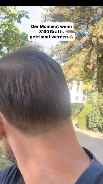 Früher und heute ist wie Winter und Sommer…
Was für eine Veränderung 🔥

newhairnewlife.com

#haartr