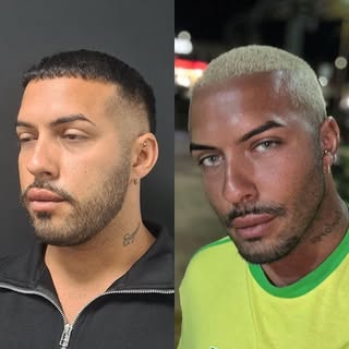 La #Bichectomia es la cirugía que nos permite afinar el rostro. Me gusta mucho como se ve en los chi