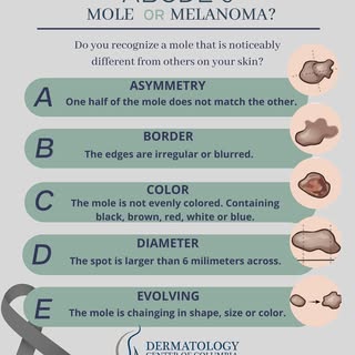 May is Melanoma Awareness Month! 🎗️
Be sure to schedule your skin check with Dr. Schiavo, it is nev
