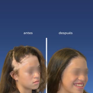La reconstrucción del marco facial puede ir más allá de lo estético: puede significar seguridad, int