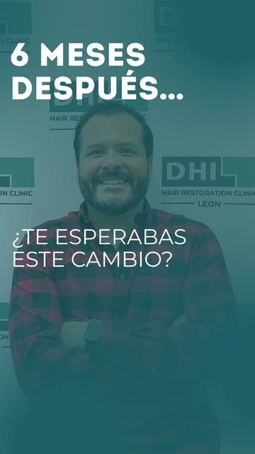 6 meses después… y el cambio ya habla por sí solo. 🔥

Más densidad, mayor cobertura y una imagen co
