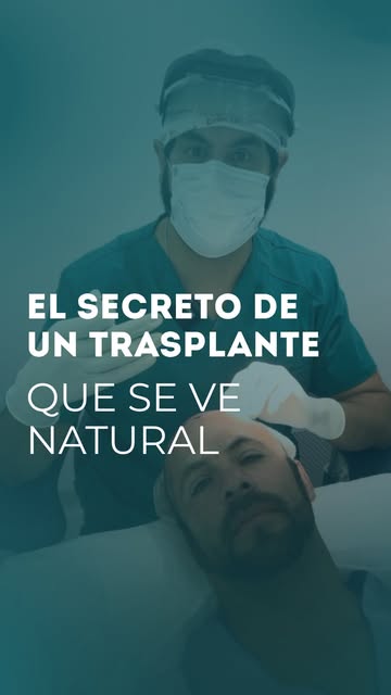 Un buen trasplante no se mide solo por cuántos cabellos implantamos, sino por cómo los distribuimos.