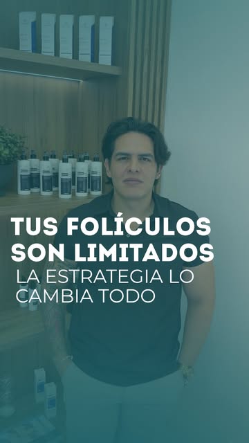Cuando la alopecia está avanzada, hacer un trasplante sin una estrategia puede no ser el mejor prime