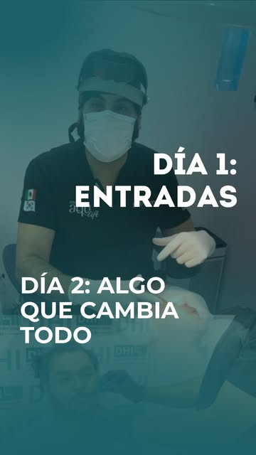 Ayer trabajamos las entradas. Hoy continuamos con la segunda parte del procedimiento: la barba.

Rel