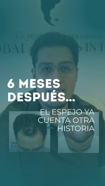 Hace 6 meses comenzó con una decisión.
Hoy, el cambio ya se ve. 🔥

Más cobertura, una imagen difere