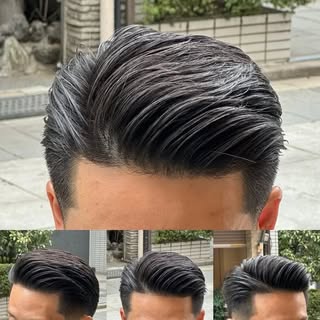 This isn’t a toupee.
This is men’s hair replacement, done right.
At HRC of Iowa, we specialize in no