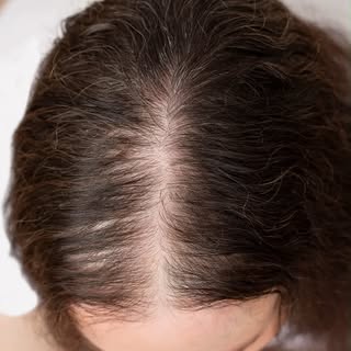 The #1 Reason Women Lose Hair #femalehairloss