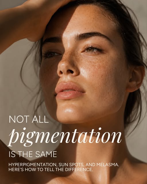 While hyperpigmentation, sunspots, and melasma may look similar, they each have different causes—and