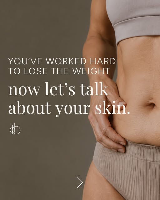 Significant weight loss can bring changes to the skin that diet and exercise alone can’t address. If