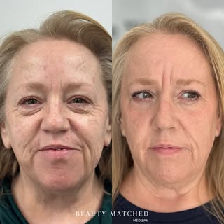 The journey is worth every step! ⏳ A stunning 8-month journey of transformation! Our lovely client t