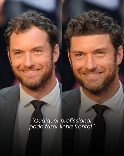 A linha frontal é uma das partes que mais entrega quando um transplante foi mal planejado. 👀
‌
Ela 