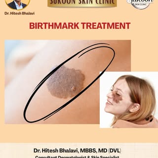 अब जन्मजात दाग और birthmarks को छुपाने की ज़रूरत नहीं! Dr. Hitesh Bhalavi, Sukoon Clinic में दे रहे 