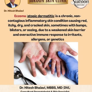 Dr. Hitesh Bhalavi explains effective treatment options for eczema and how timely care can help mana