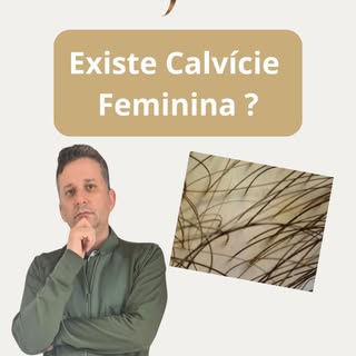 🌟 **Calvície Feminina: Existe?** 🌟

Neste vídeo, vamos esclarecer uma questão crucial: a calvície 