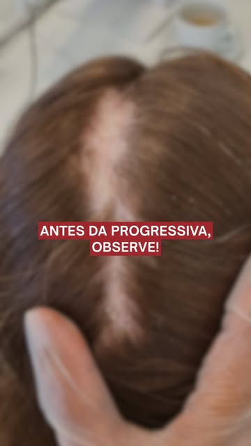🚨 Quando o couro cabeludo apresenta sinais de inflamação, o procedimento químico não deve continuar