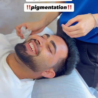 ✨ Say goodbye to stubborn pigmentation and hello to glowing, even-toned skin! ✨

Watch this amazing 
