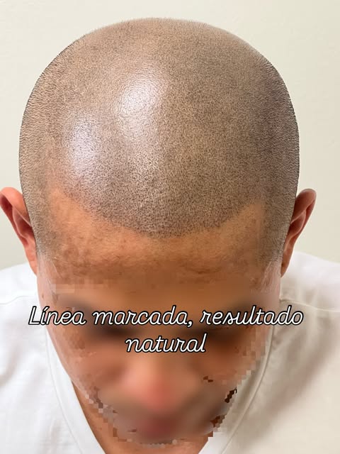 Este cliente venía buscando algo muy concreto: una línea frontal marcada, con carácter. El reto era 