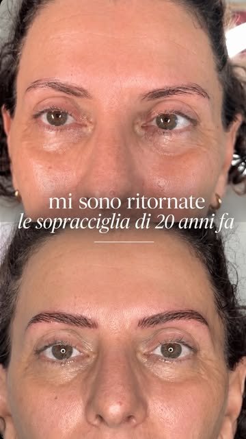 Ci sono dettagli del nostro viso che cambiano con il tempo… e a volte ci accorgiamo di quanto ci man