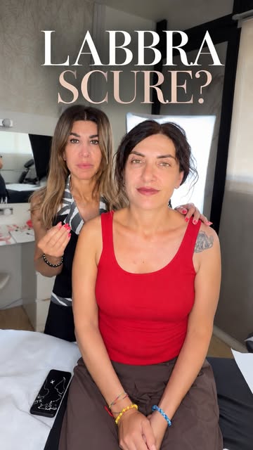 Questa cliente è venuta da me perché non si piaceva per il colore naturalmente scuro delle sue labbr
