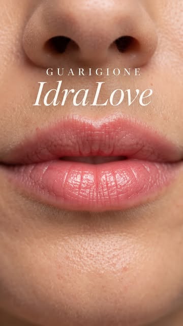 Cosa succede alle tue labbra dopo il trattamento IdraLove®️? 🤍

Appena finito il colore è leggermen