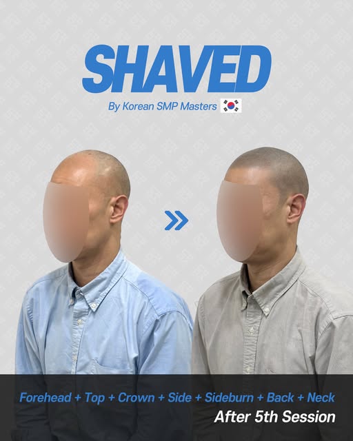 操作Shaved紋髮🪒的三大核心關鍵‼️

想要擁有近看也毫無破綻的完美紋髮效果💯📍髮際線矯正📍質感呈現📍色調深淺度缺一不可💫如果沒有處理好,做出來的視覺效果就會顯得不自然又生硬 🙅‍♂