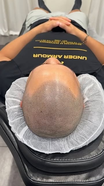 ✨想打造自然、有型的SHAVED紋髮效果？這3個關鍵缺一不可！

1️⃣ 紋髮效果能否自然融入原生毛髮
2️⃣ 由髮際線延伸至頭頂，能否呈現自然的深淺與密度漸層
3️⃣ 髮際線設計是否貼合個人臉型、頭