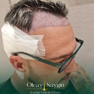 Zen Hair – Safe, Professional, and Personalized Hair Transplant Care
At Zen Hair, our priority is to